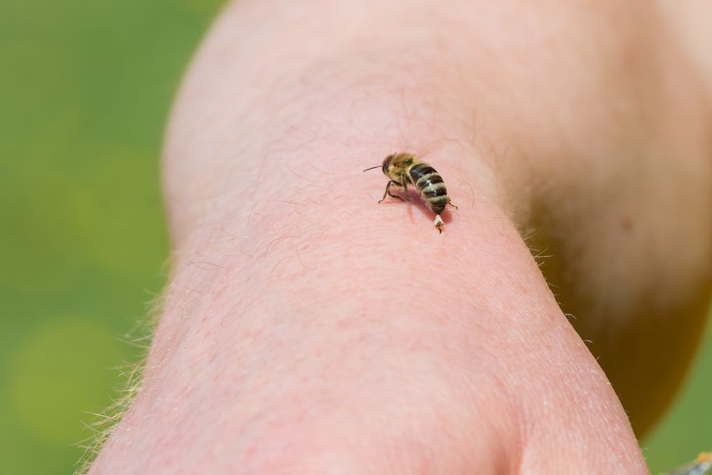 Does A Bee Sting Itch When Healing